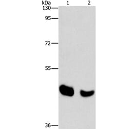 BAAT Antibody from Signalway Antibody (36274) - Antibodies.com