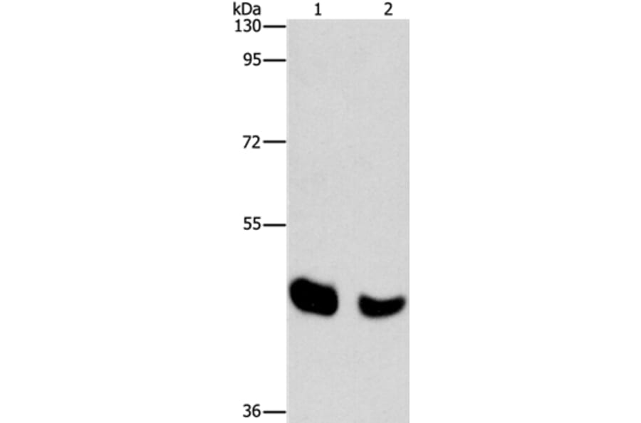 BAAT Antibody from Signalway Antibody (36274) - Antibodies.com