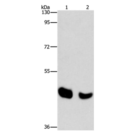 BAAT Antibody from Signalway Antibody (36274) - Antibodies.com