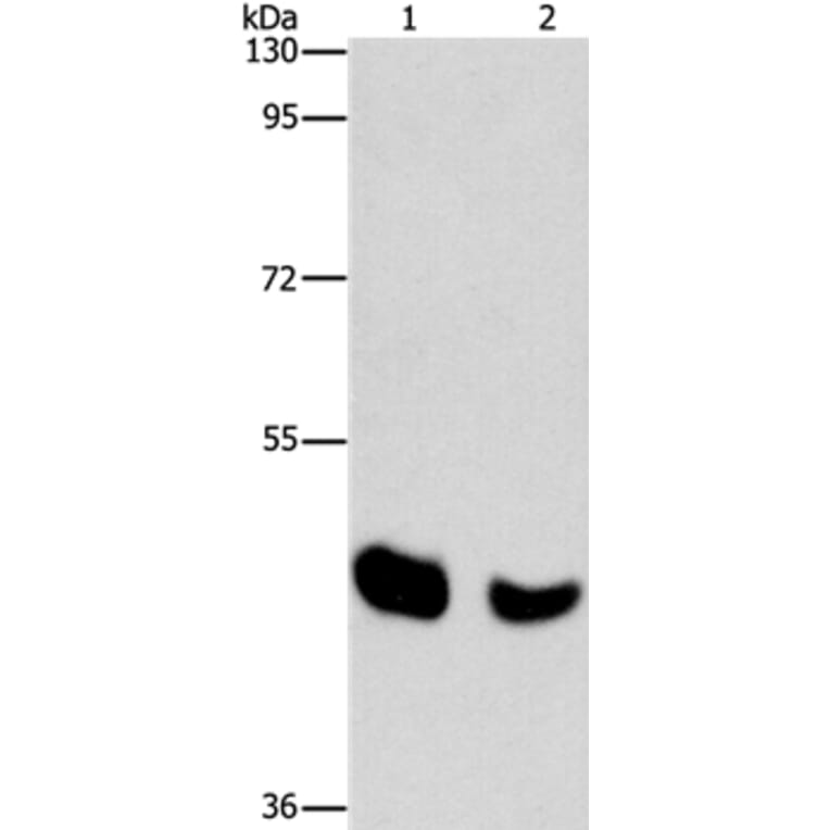 BAAT Antibody from Signalway Antibody (36274) - Antibodies.com