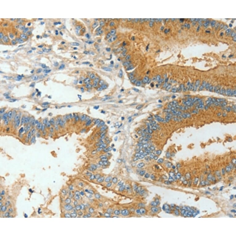Immunohistochemistry - BAAT Antibody from Signalway Antibody (36274) - Antibodies.com