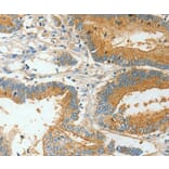 Immunohistochemistry - BAAT Antibody from Signalway Antibody (36274) - Antibodies.com