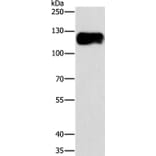 CAST Antibody from Signalway Antibody (36300) - Antibodies.com
