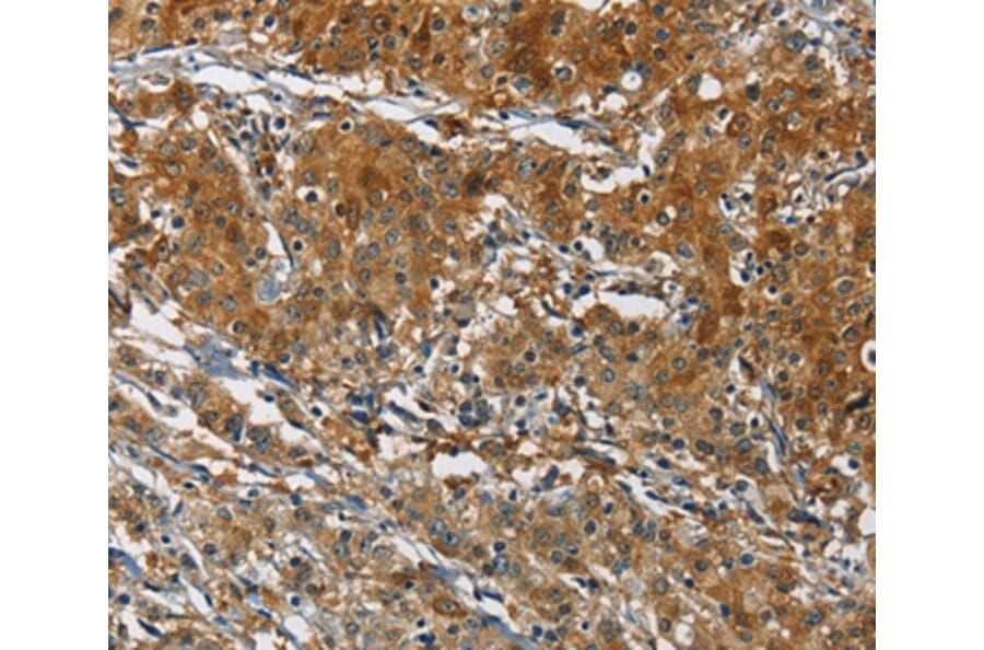 Immunohistochemistry - CAST Antibody from Signalway Antibody (36300) - Antibodies.com