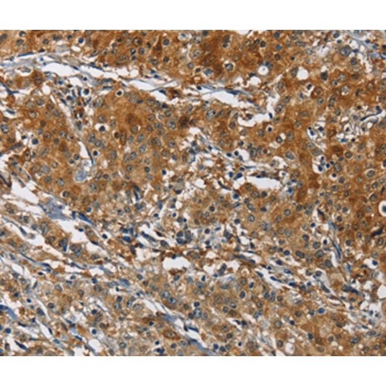 Immunohistochemistry - CAST Antibody from Signalway Antibody (36300) - Antibodies.com
