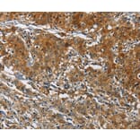 Immunohistochemistry - CAST Antibody from Signalway Antibody (36300) - Antibodies.com