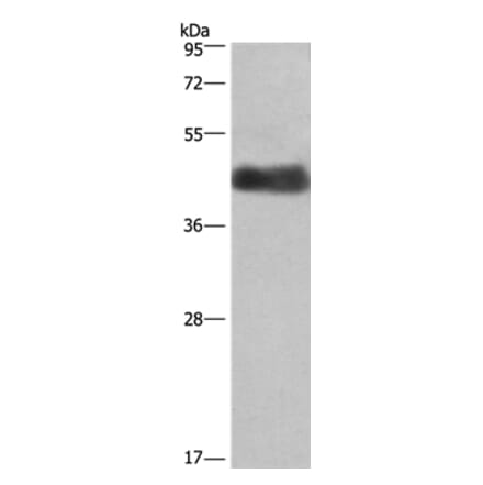 CALU Antibody from Signalway Antibody (36302) - Antibodies.com