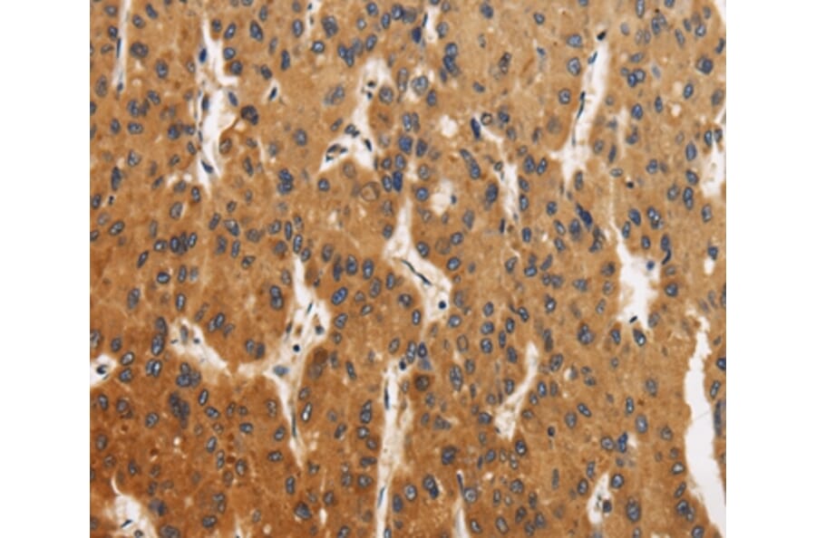 Immunohistochemistry - CALU Antibody from Signalway Antibody (36302) - Antibodies.com