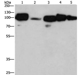 CANX Antibody from Signalway Antibody (36304) - Antibodies.com