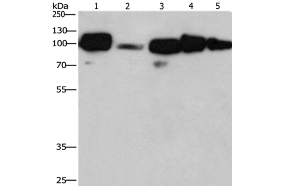 CANX Antibody from Signalway Antibody (36304) - Antibodies.com