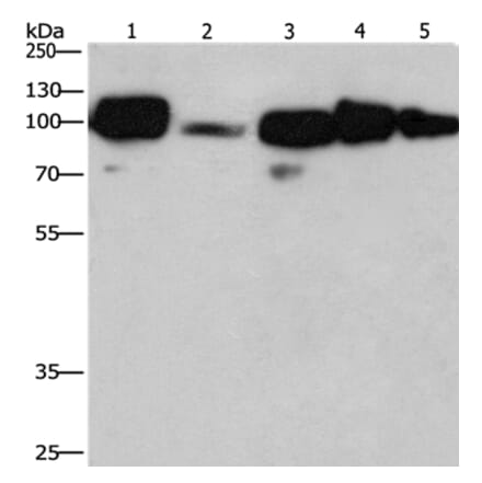 CANX Antibody from Signalway Antibody (36304) - Antibodies.com