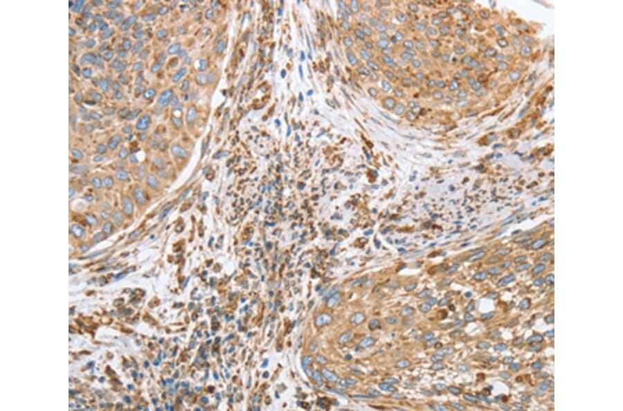 Immunohistochemistry - CANX Antibody from Signalway Antibody (36304) - Antibodies.com