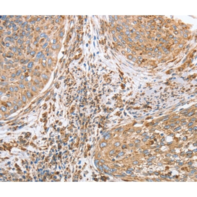 Immunohistochemistry - CANX Antibody from Signalway Antibody (36304) - Antibodies.com