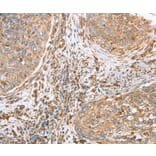 Immunohistochemistry - CANX Antibody from Signalway Antibody (36304) - Antibodies.com