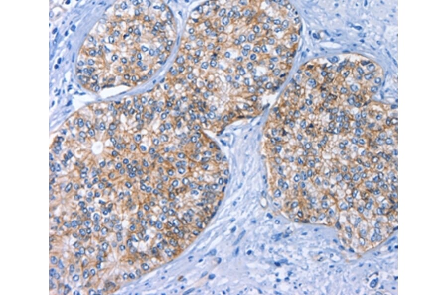 Immunohistochemistry - BCAM Antibody from Signalway Antibody (36328) - Antibodies.com
