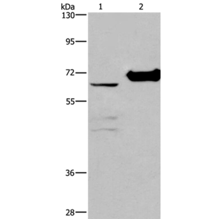 CHDH Antibody from Signalway Antibody (36348) - Antibodies.com