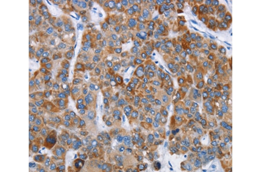 Immunohistochemistry - CHDH Antibody from Signalway Antibody (36348) - Antibodies.com