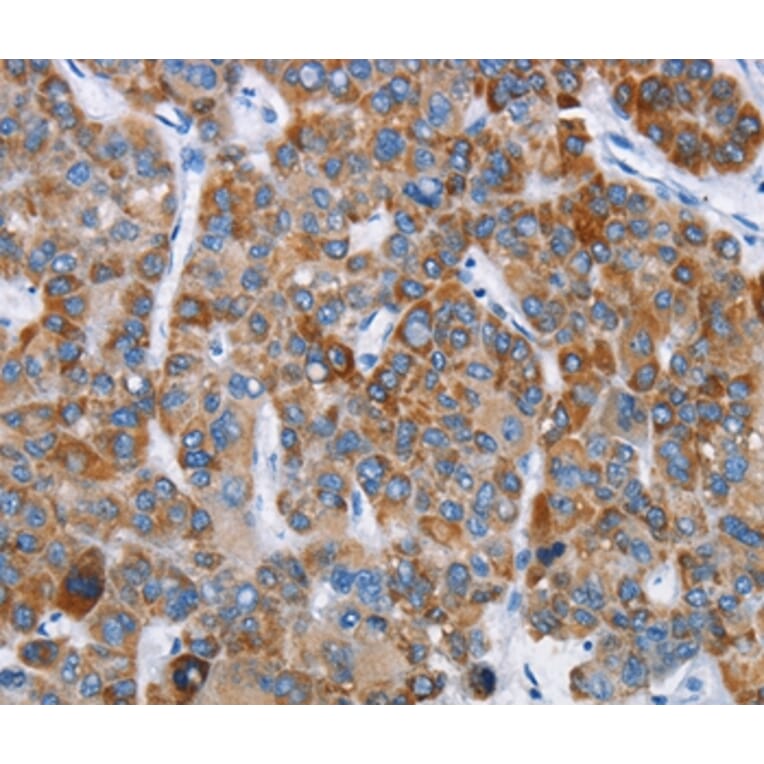 Immunohistochemistry - CHDH Antibody from Signalway Antibody (36348) - Antibodies.com