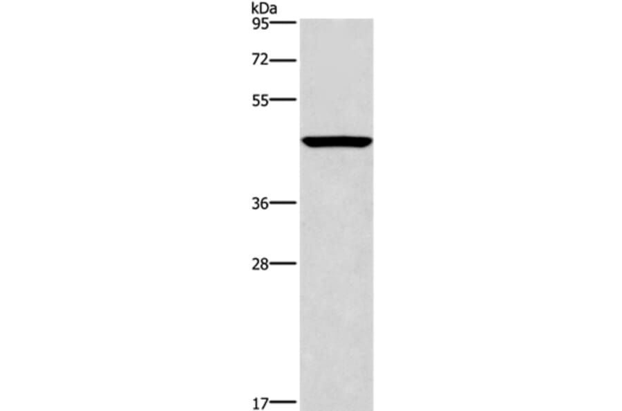 CPA2 Antibody from Signalway Antibody (36364) - Antibodies.com