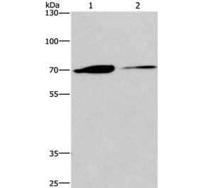 CROT Antibody from Signalway Antibody (36373) - Antibodies.com