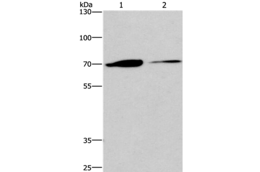 CROT Antibody from Signalway Antibody (36373) - Antibodies.com