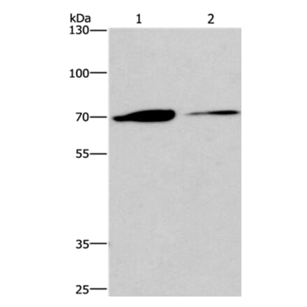 CROT Antibody from Signalway Antibody (36373) - Antibodies.com