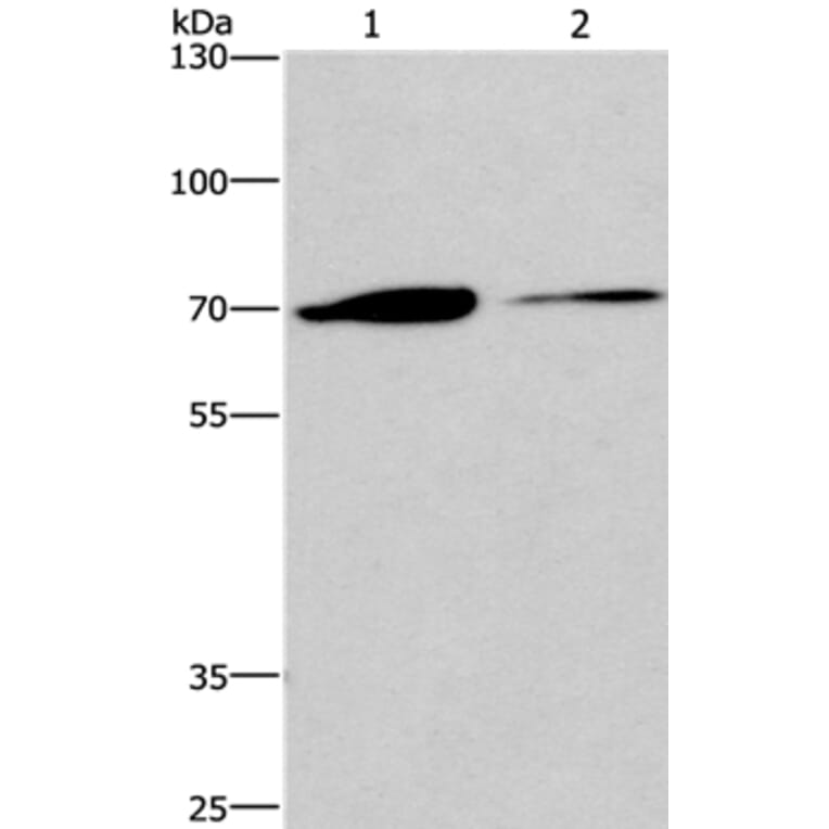 CROT Antibody from Signalway Antibody (36373) - Antibodies.com