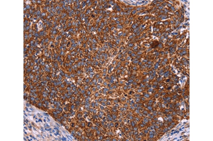 Immunohistochemistry - CROT Antibody from Signalway Antibody (36373) - Antibodies.com
