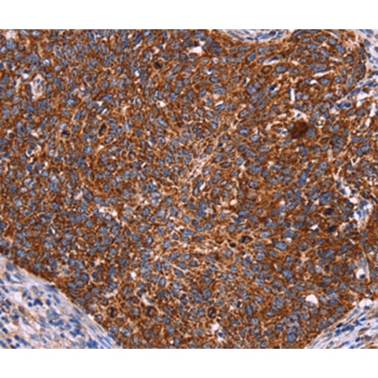 Immunohistochemistry - CROT Antibody from Signalway Antibody (36373) - Antibodies.com