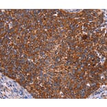 Immunohistochemistry - CROT Antibody from Signalway Antibody (36373) - Antibodies.com