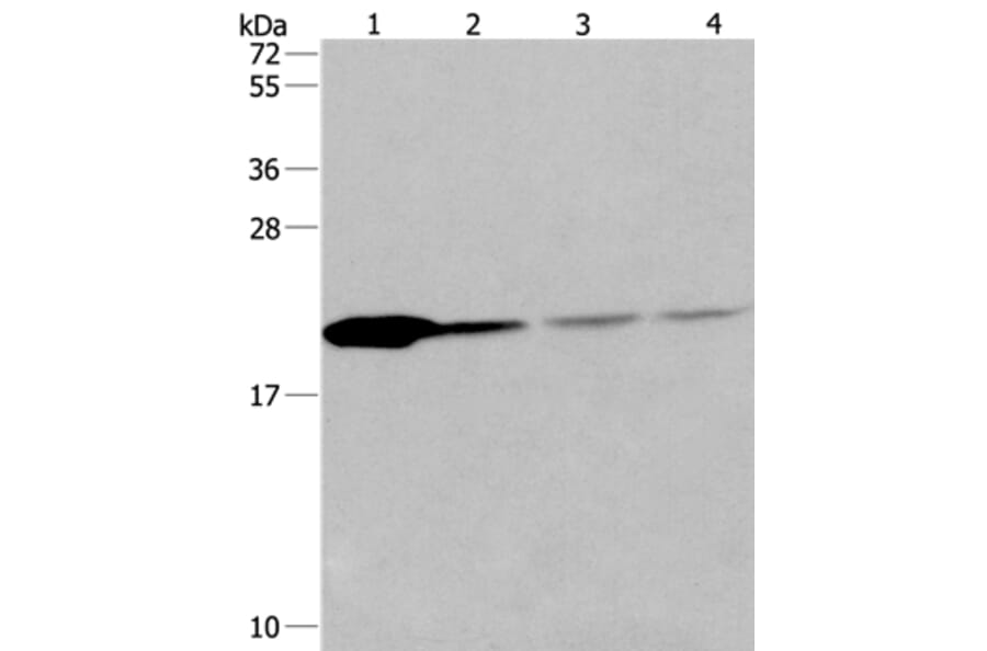 PPIB Antibody from Signalway Antibody (36382) - Antibodies.com