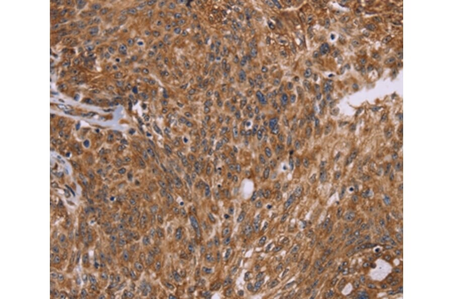 Immunohistochemistry - PPIB Antibody from Signalway Antibody (36382) - Antibodies.com