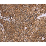 Immunohistochemistry - PPIB Antibody from Signalway Antibody (36382) - Antibodies.com
