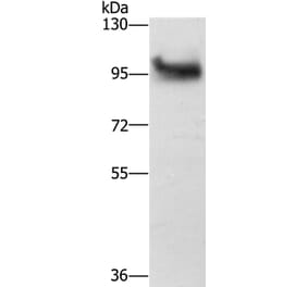 DAB2 Antibody from Signalway Antibody (36395) - Antibodies.com