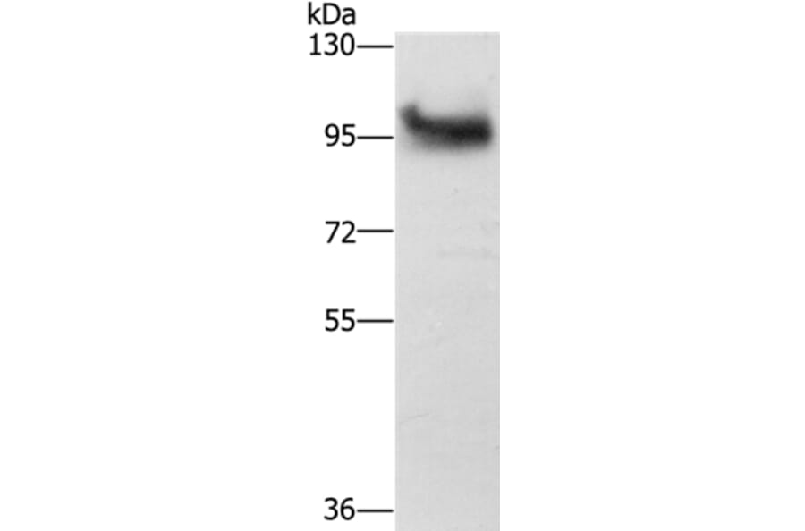 DAB2 Antibody from Signalway Antibody (36395) - Antibodies.com