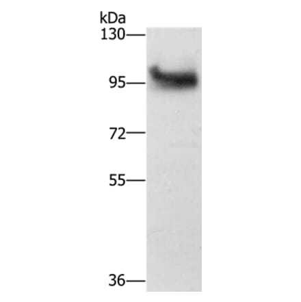 DAB2 Antibody from Signalway Antibody (36395) - Antibodies.com