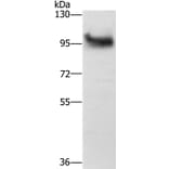 DAB2 Antibody from Signalway Antibody (36395) - Antibodies.com