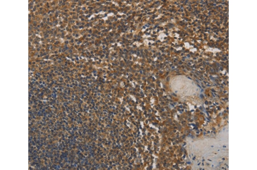 Immunohistochemistry - DAB2 Antibody from Signalway Antibody (36395) - Antibodies.com