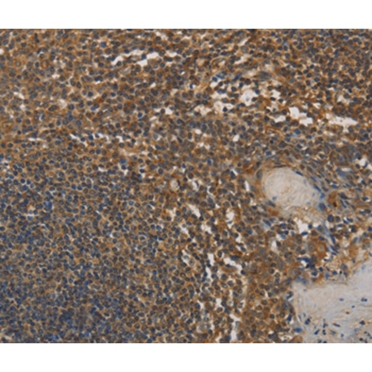 Immunohistochemistry - DAB2 Antibody from Signalway Antibody (36395) - Antibodies.com