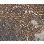 Immunohistochemistry - DAB2 Antibody from Signalway Antibody (36395) - Antibodies.com