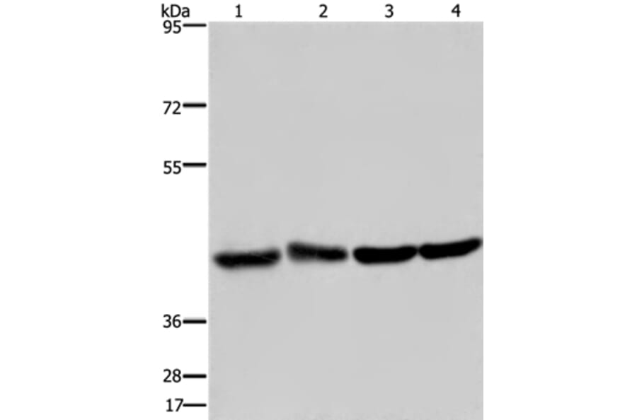 DRG1 Antibody from Signalway Antibody (36423) - Antibodies.com