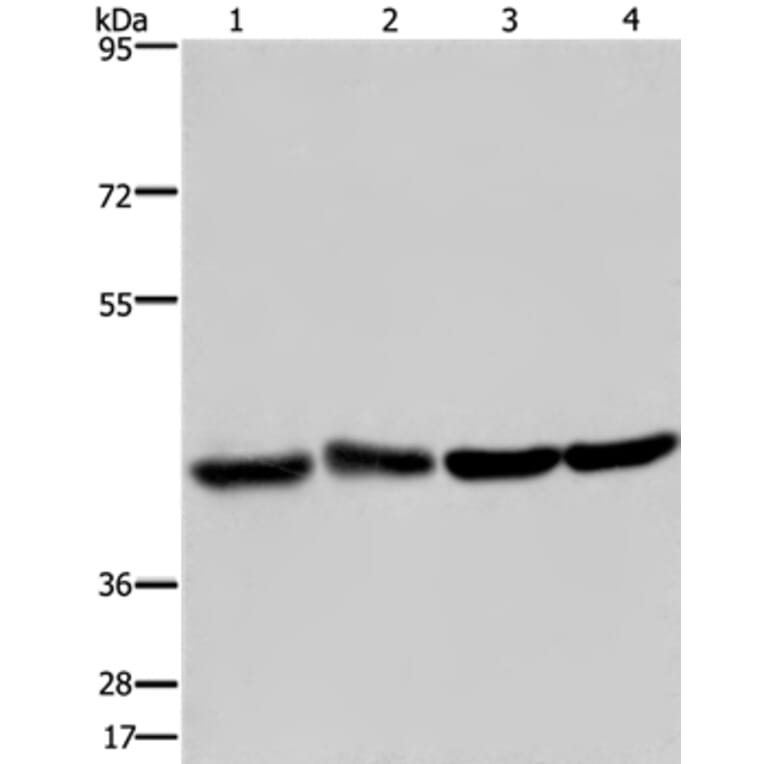 DRG1 Antibody from Signalway Antibody (36423) - Antibodies.com