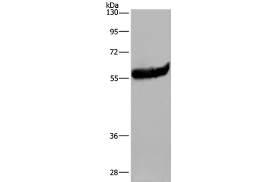 ESR2 Antibody from Signalway Antibody (36447) - Antibodies.com