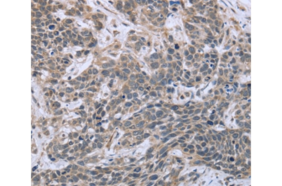 Immunohistochemistry - ESR2 Antibody from Signalway Antibody (36447) - Antibodies.com