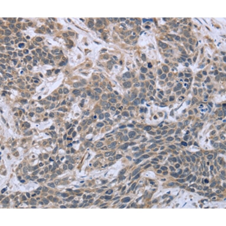 Immunohistochemistry - ESR2 Antibody from Signalway Antibody (36447) - Antibodies.com