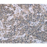 Immunohistochemistry - ESR2 Antibody from Signalway Antibody (36447) - Antibodies.com