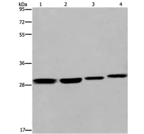 ETV7 Antibody from Signalway Antibody (36452) - Antibodies.com