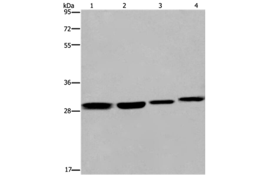 ETV7 Antibody from Signalway Antibody (36452) - Antibodies.com