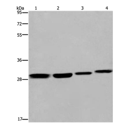 ETV7 Antibody from Signalway Antibody (36452) - Antibodies.com