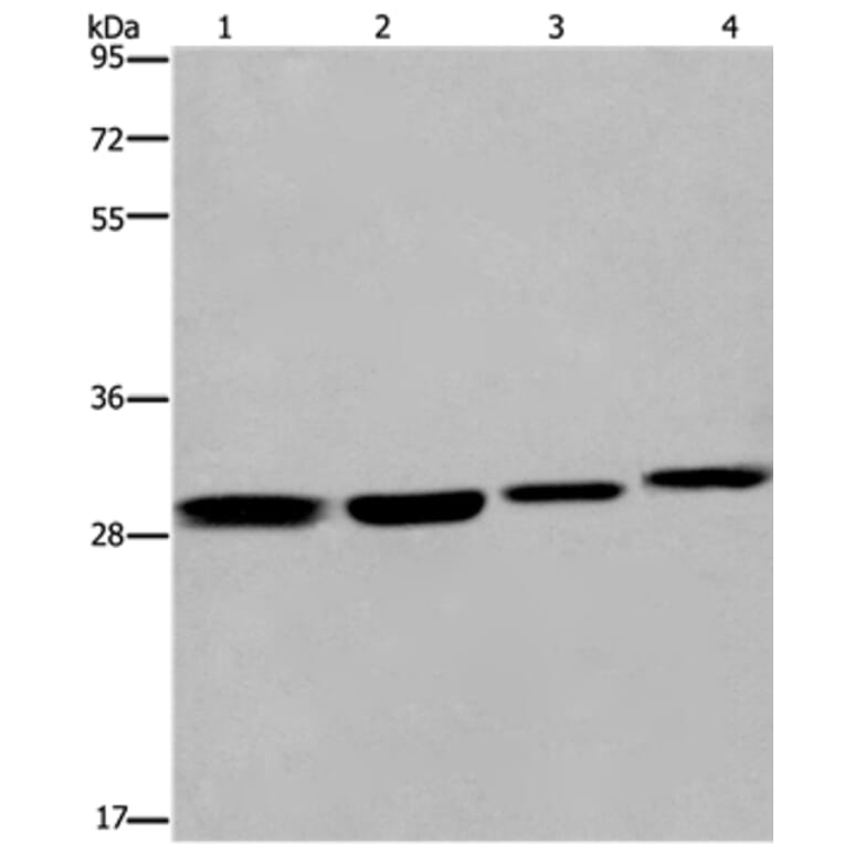 ETV7 Antibody from Signalway Antibody (36452) - Antibodies.com